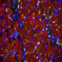 Heart Cells